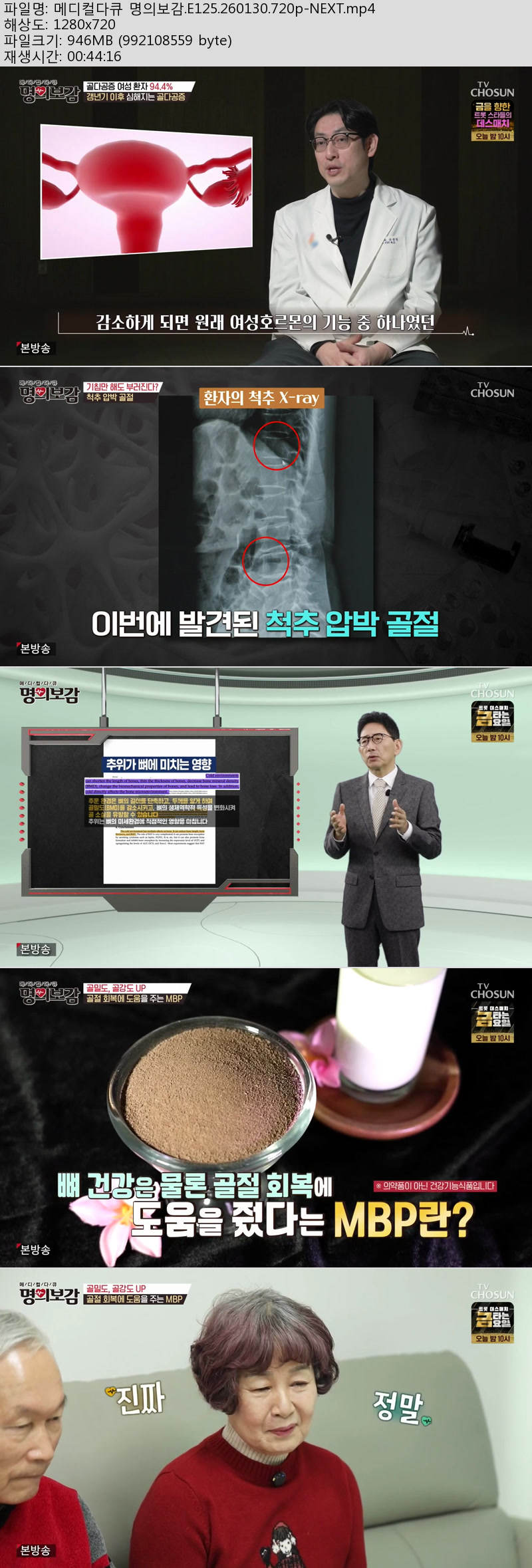 메디컬다큐 명의보감.E125.260130.720p-NEXT
