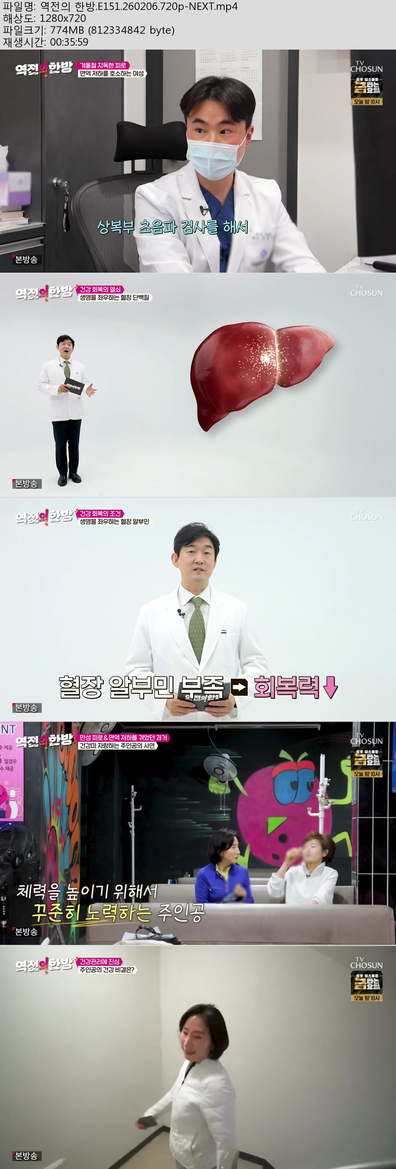 역전의 한방.E151.260206.720p-NEXT