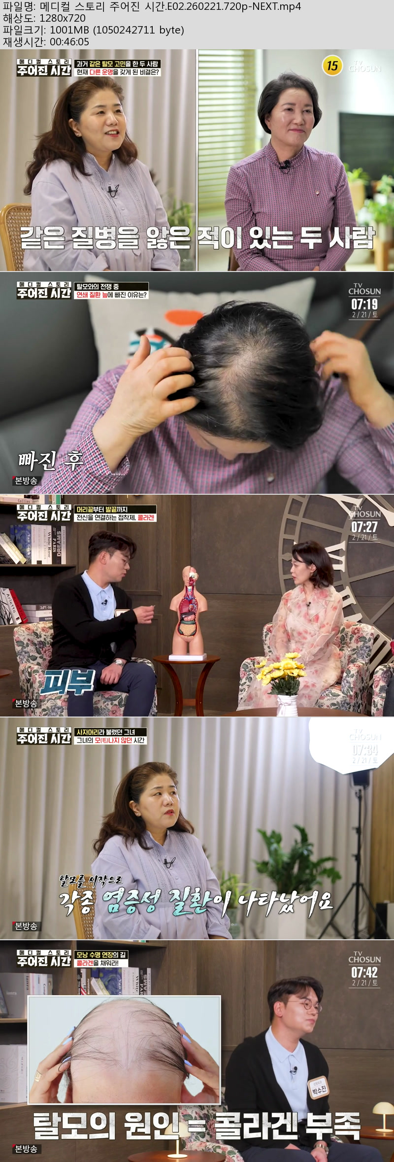 메디컬 스토리 주어진 시간.E02.260221.720p-NEXT